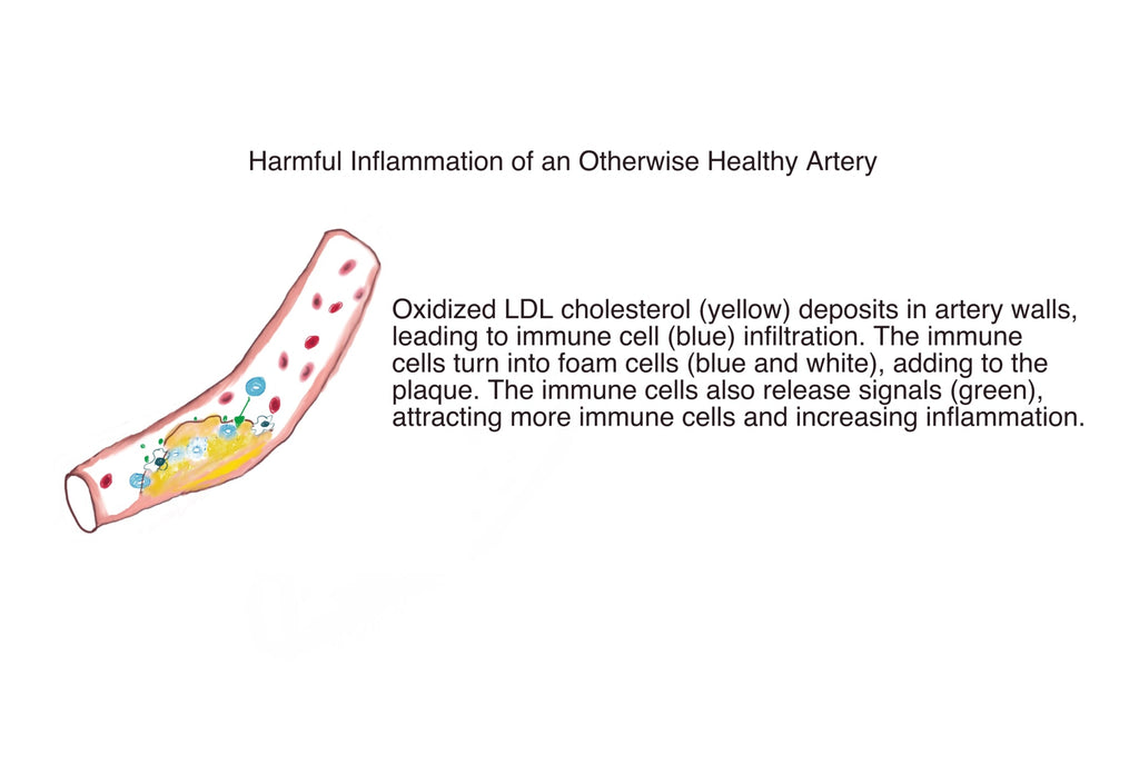 Tea and Helpful vs Harmful Inflammation